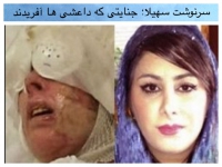 سهیلا جورکش يكي از قربانیان اسیدپاشی‌هاي اصفهان از مردم درخواست کمک کرد